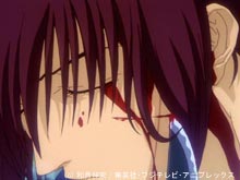 第四幕『十字傷』