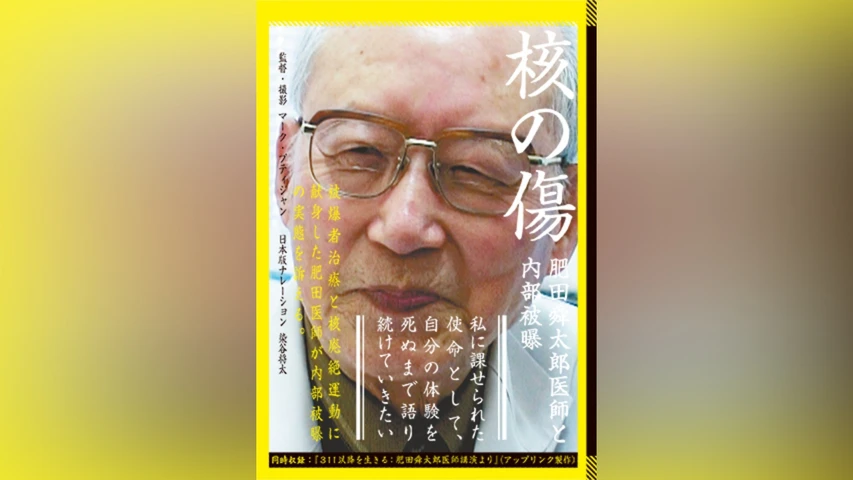 核の傷:肥田舜太郎医師と内部被曝